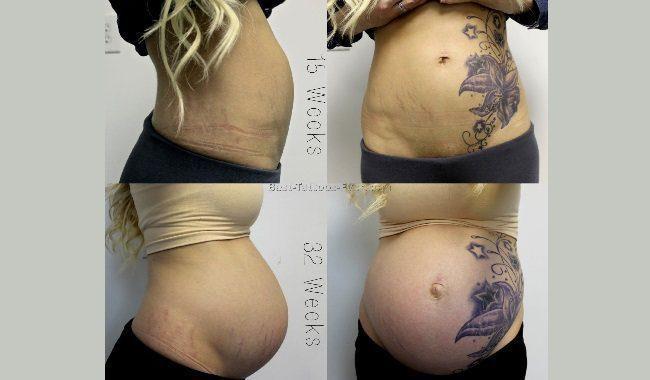 What will the tattoo look like after childbirth?