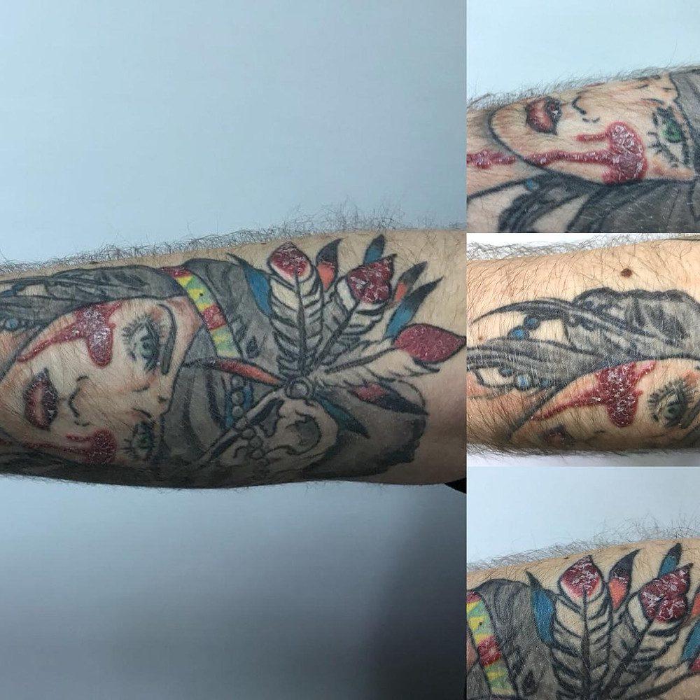Pittura di tatuaggi: puderete esse allergicu à elli?