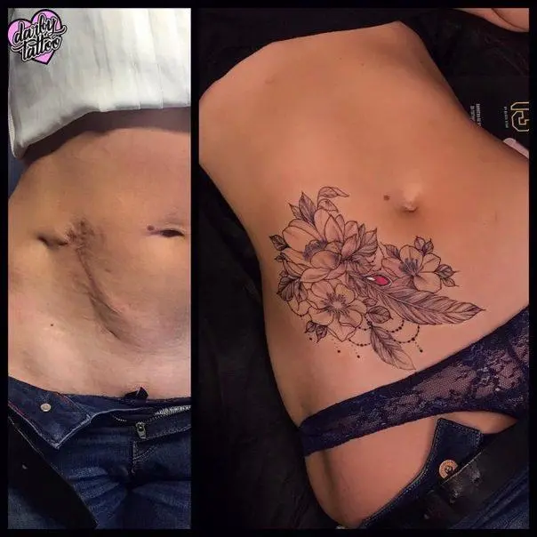 Rodolfo Torres, the artist who makes stretch marks disappear with a tattoo