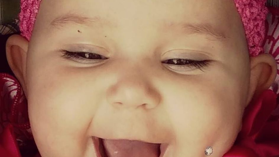 США: фото ребенка с пирсингом в щеке вызвало скандал