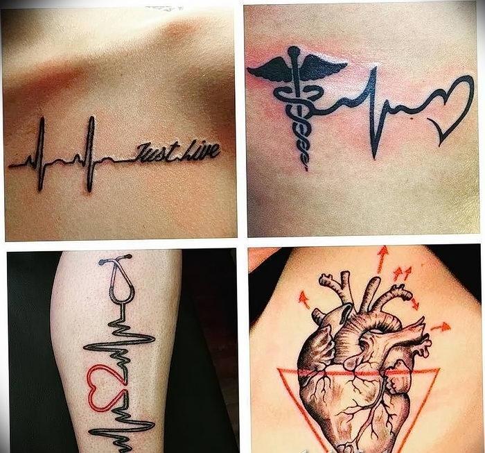 Medisinsk tatovering: når tatoveringen redder livet ditt