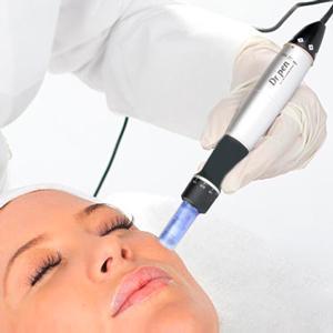 Needle mesotherapy of the scalp