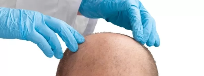 Massage è trasplante di capelli