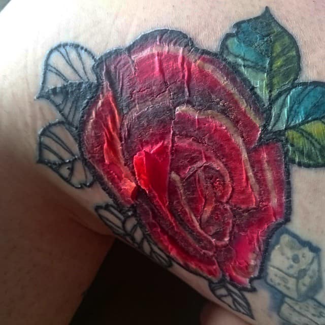 Кровоточивость парши при татуировке: почему это происходит и как ее предотвратить?