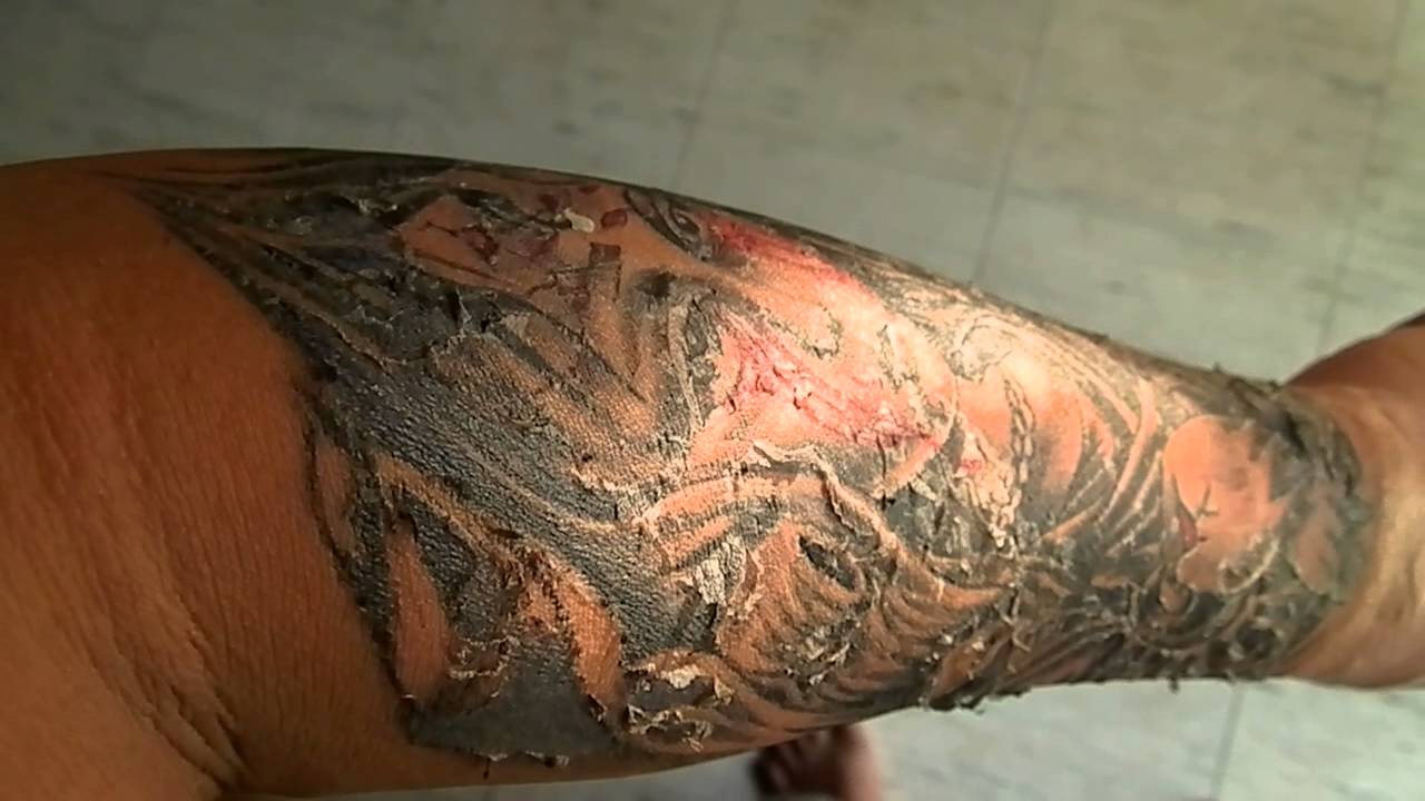 Можно ли сделать татуировку, если кожа шелушится от загара?