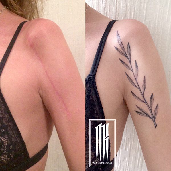 Cicatrici e inchiostro: una guida per coprire le cicatrici con i tatuaggi