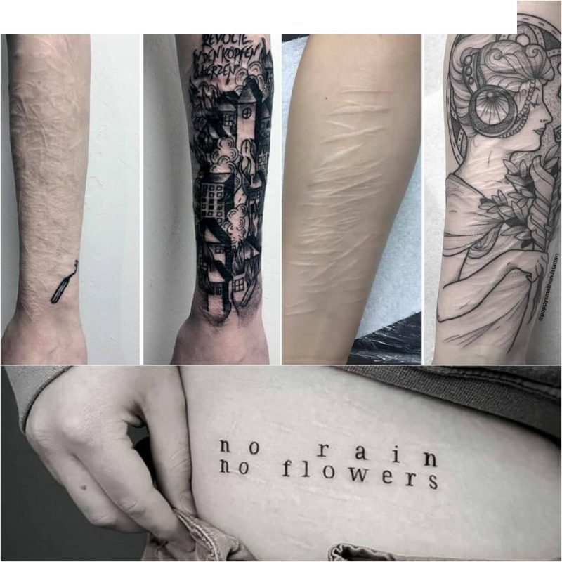 Tatouage de cicatrice - Avantages et inconvénients des tatouages ​​​​de cicatrice