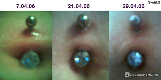 Èske piercing pwent tete mwen an enfekte?
