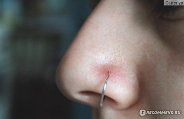 Je váš piercing v nose infikovaný?